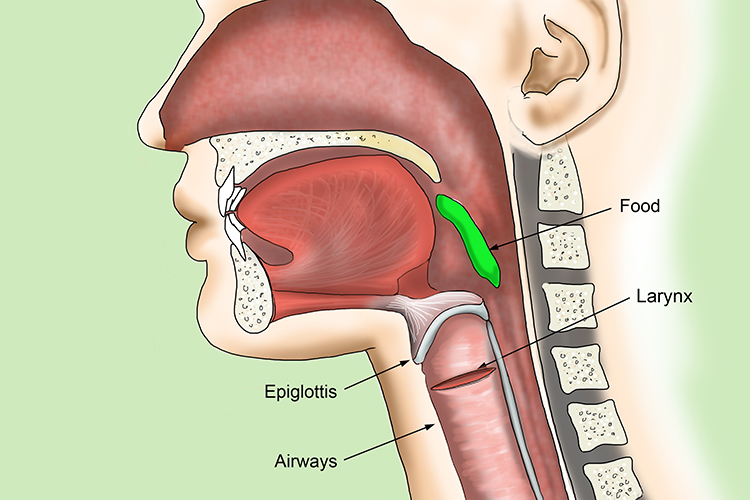 Image shows where the epiglottis is in the throat